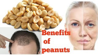 Benefits of peanut|Antiaging|Baldness - YouTube