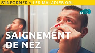 Information patient | Saignement de nez \