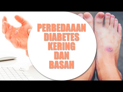 Video: Siapa yang mengeringkan bercak darah?