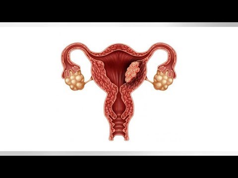 Wideo: Przestrzenna Organizacja Ekspresji Genów Endometrium Na Początku Przywiązywania Zarodków U świń
