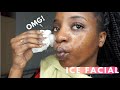 I Rubbed ICE CUBES On My Face For 1 Week