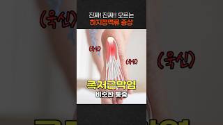발바닥 통증, 뒤꿈치 아프다고 무조건 족저근막염? No!! 다리 멍 잘들면 이것 의심해야!!
