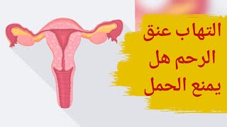 التهاب عنق الرحم هل يمنع الحمل؟؟