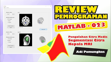 Review Pemrograman MATLAB - 023 - Segmentasi Citra Kepala MRI Menggunakan Metode Active Contour