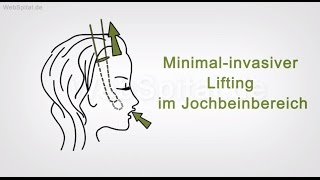 Mittelgesichtslifting Oder Mittelgesichtsstraffung