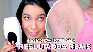 RESULTS: CHINESE IPL HAIR REMOVAL ("SKIN SOFT") VS. PHILIPS LUMEA | JÉSSICA AMBRÓSIO screenshot 1