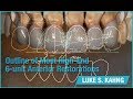 Outline of Most High End 6 unit Anterior Restorations