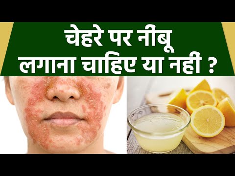 Face पर Lemon लग न स क य ह त ह च हर पर न ब लग न स क य ह त ह Boldsky Health