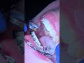 SATISFYING BRACES REMOVAL ASMR! 🤩🎧 Tooth Time Family Dentistry