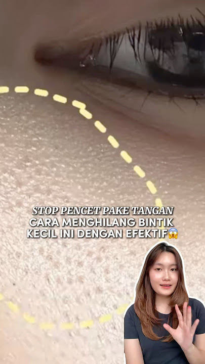Stop pencet pake tangan cara menghilangkan bintik kecil ini dengan efektif😱