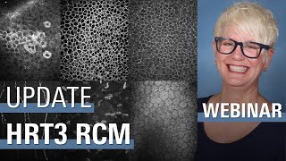 Update Corneal Microscopy | HRT3 RCM