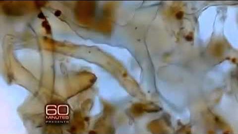 Real dinosaur still-soft biological tissue on ABC