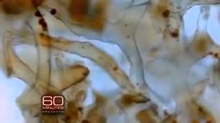 Real dinosaur still-soft biological tissue on ABC's 60 Minutes screenshot 2