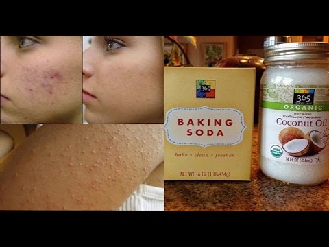 Baking soda and coconut oil to face - prescription acne and facial cleansers / Natural Master No.