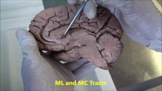 Video 9 Summary Conclusion