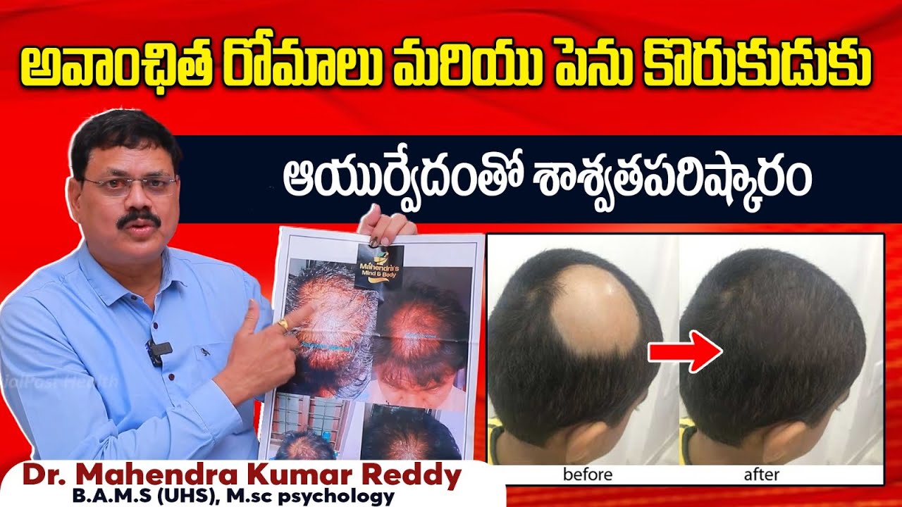 Hair Loss Treatment Unwanted Hair Removal in Ayurveda Alopecia