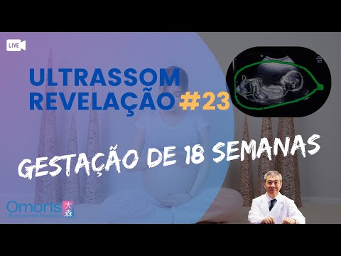 Obstetric ultrasound. Baby Gender Reveal LIVE - 18 weeks pregnant. Ultrasound #23