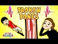 Science for kids  body parts  broken bones  experiments for kids  operation ouch