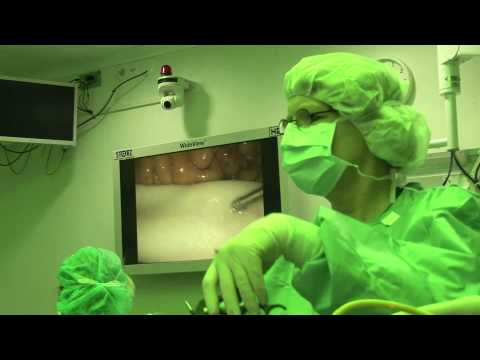 Video: MAC-anesthesie (gecontroleerde Anesthesiezorg)