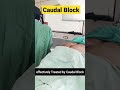 Caudal Block for Failed Back pain and Sciatica Pain ✓✓ #backpain#lowbackpain #sciaticapain #sciatica