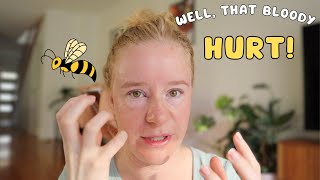 Koren Skincare Haul + I got stung on the face!!! 🐝