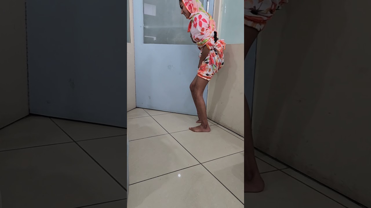 Tip Toes Walking in Cerebral Palsy