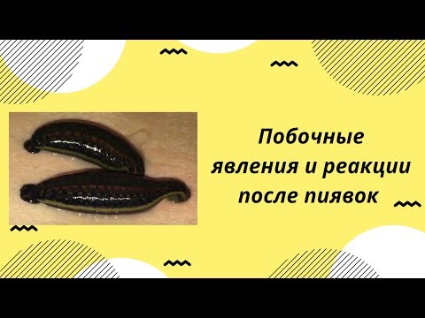 Пиявки: побочные явления. Приставочная реакция после пиявок