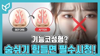 숨 쉬기가 불편하다고요? 비염·코막힘… 단순한 문제가 아닐 수 있습니다 ㅣ 비중격만곡증·비밸브협착증·비염까지 기능코성형 총정리