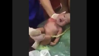 doctors and Nurses save life of baby who born dead