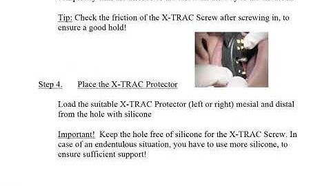 Easy X-TRAC instructions