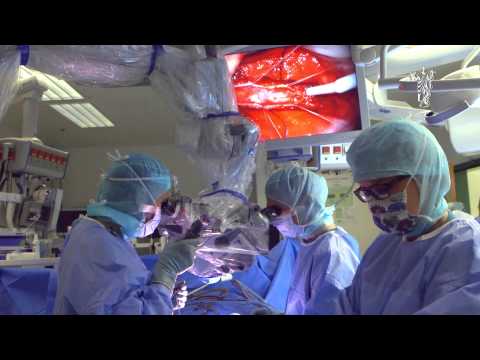 Video: Nevrokirurg - Konsultasjon, Mottakelse, Spesialisering