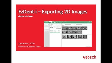 EzDent-i : Exporting 2D Images