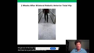 "The EDGE: Enhanced Direct Anterior Robotic Hip Replacement"