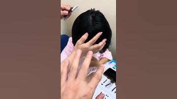 Bí quyết ngăn ngừa rụng bạc tóc Cào hai đầu Diện Chẩn