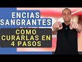 ENCIAS INFLAMADAS y SANGRANTES 😳 Como CURARLAS en 4 PASOS [Funciona] 😃✌