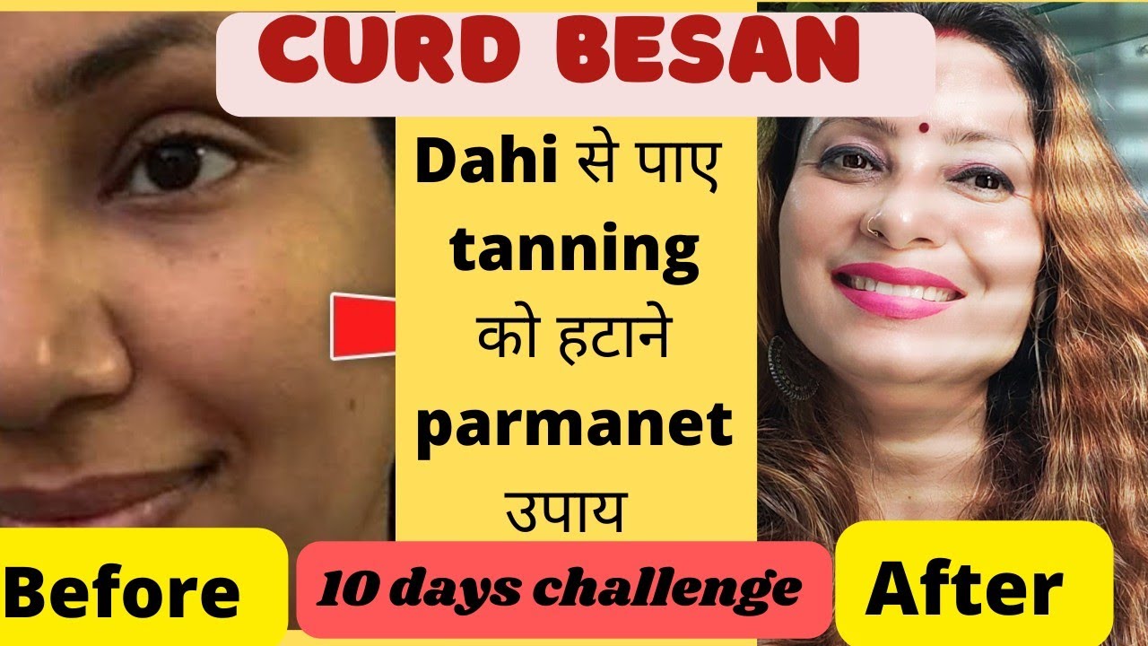 10 DAYS *TAN REMOVAL* CHALLENGE सबसे Effective Sun Tan Removal Remedy
