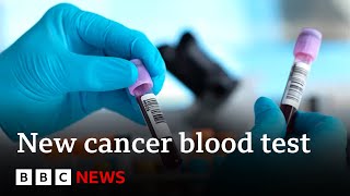 Blood test for more than 50 cancers 