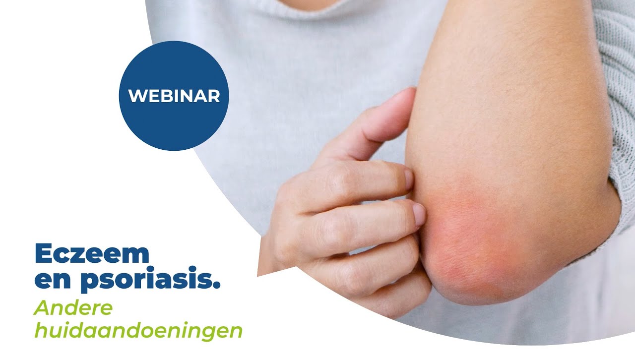 Let’s Talk – Eczema en psoriasis – 6. Andere huidziekten - Multipharma
