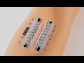 How to Use the Foldable Skin Closure