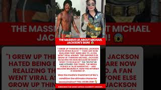 Michael Jackson Vitiligo Truth Revealed
