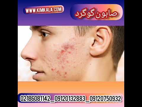 بهترین صابون گوگرد ۰۹۱۲۰۷۵۰۹۳۲ بهترین صابون برای جوش