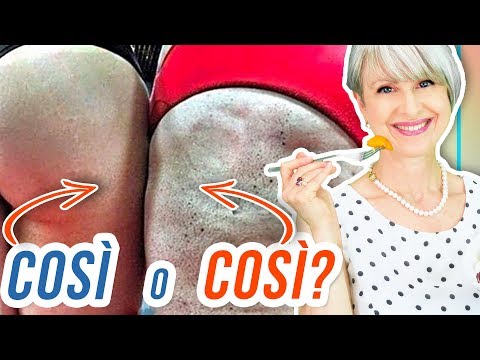 fai-questo-e-dimagrisci-cosce,-fianchi-e-glutei-per-la-prova-costume