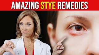 Home Remedies for Stye | Dr. Janine