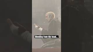 Oli Sykes hit in the head by phone at BMTH causing injury 🤦♂️ #bringmethehorizon #bmth #concert