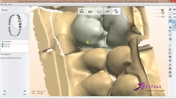 Digital CAD Blocks (IPS.e.max CAD)
