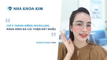Răng Đều, Đẹp Hơn Chỉ Sau 6 Tháng Niềng Invisalign