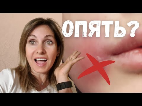 Как лечить фурункул на лице. Что такое гомеопатия -лженаука?