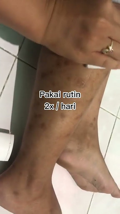 Semoga kalian yan sedang berjuang bisa tercapai juga ya...