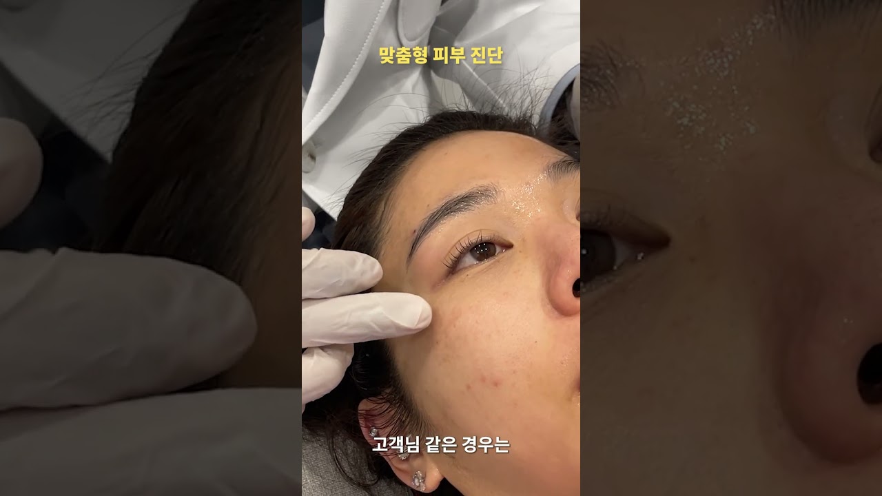 [뷰티블라썸의원] 울디엠으로 탄력UP, 리쥬란아이로 눈가까지 완벽하게💫 외국인 체험 공개