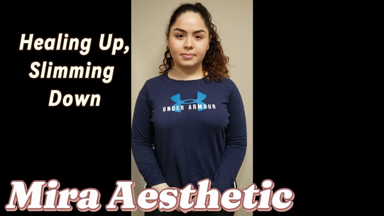 Liposuction Orange County: Real Patient Results & Recovery Story